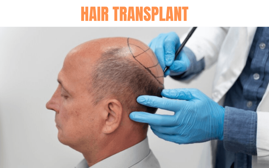 A person undergoing surgical procedure with a medical professional marking the scalp using a tool