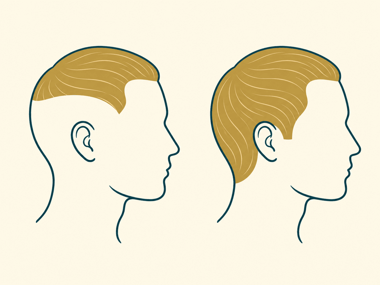 Illustration: a toupee covers only the top of the head, a wig covers the whole head — AI-generated illustration